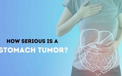 How Serious is a Stomach Tumor ?