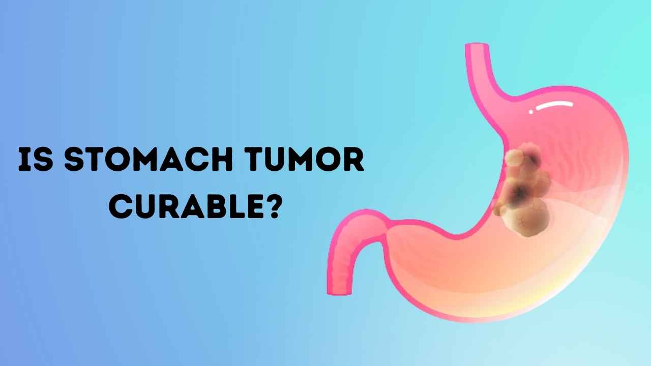 is+stomach+tumor+curable