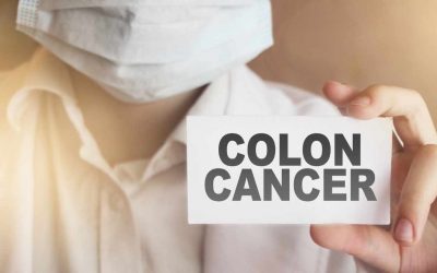 Is Colon Cancer Curable if Caught Early?