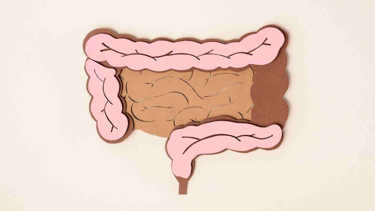 what are stages of colorectal cancer