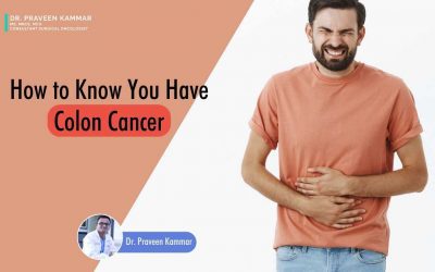 How to know if you have colon cancer