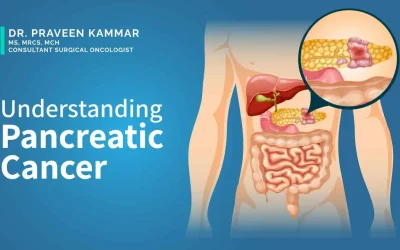 Understanding what is Pancreatic Cancer