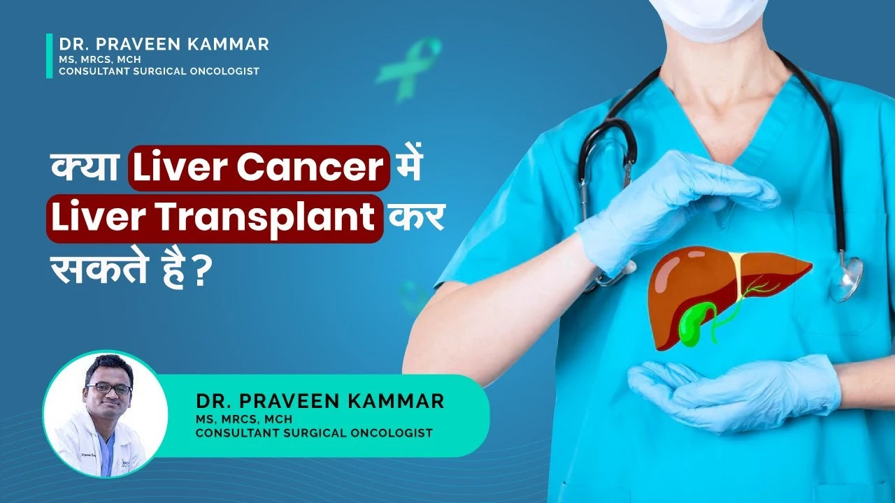 Conquer Liver Cancer With a Successful Liver Transplant
