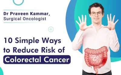 10 Ways to Reduce Your Risk of Colorectal Cancer