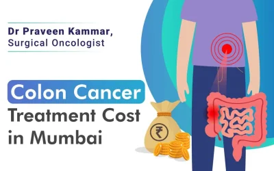 Affording Colon Cancer Treatment in Mumbai: Insights Cost