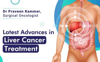The Latest Advances in Liver Cancer Treatment