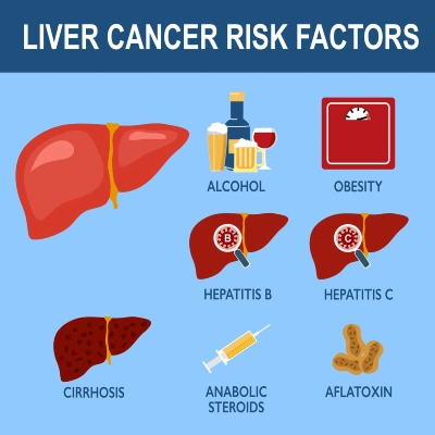 liver cancer risk factors