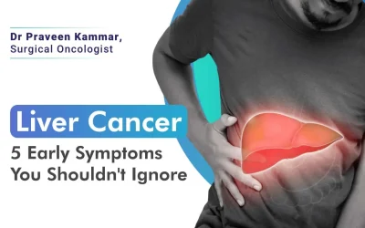 Liver Cancer: 5 Early Symptoms You Shouldn’t Ignore