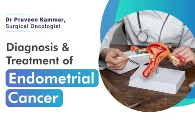 Diagnosis & Treatment of Endometrial Cancer – Dr. Praveen Kammar