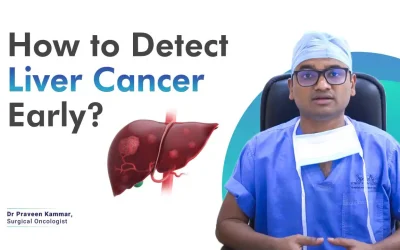 Early Detection Matters: How to Detect Liver Cancer Early