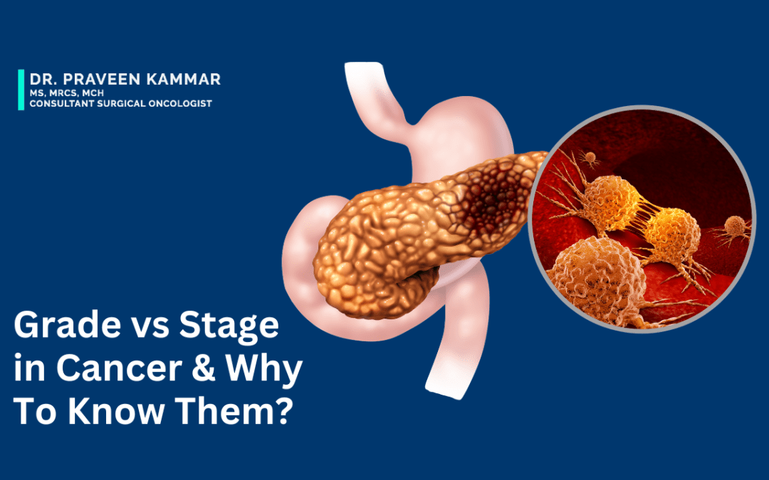 Stage Vs Grade in GI Cancers & Why Are They Important?
