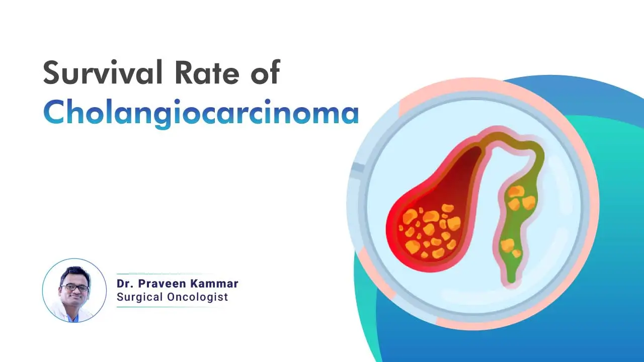 survival rate of cholangiocarcinoma survival rate of cholangiocarcinoma