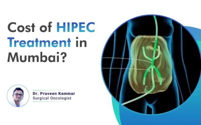 Cost of HIPEC Treatment in Mumbai