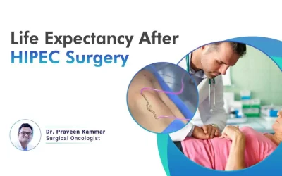 Life expectancy after HIPEC surgery