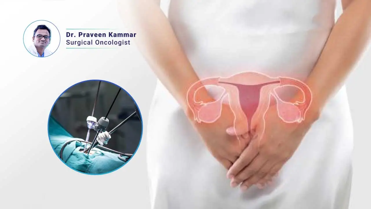 Can You Get Vaginal Cancer After a Hysterectomy?