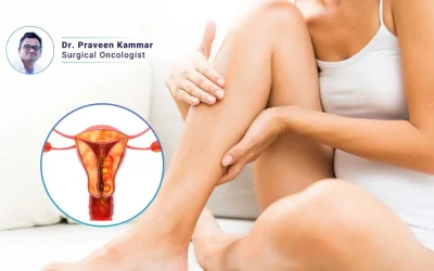 Is Your Leg Pain a Sign of Uterine Cancer?
